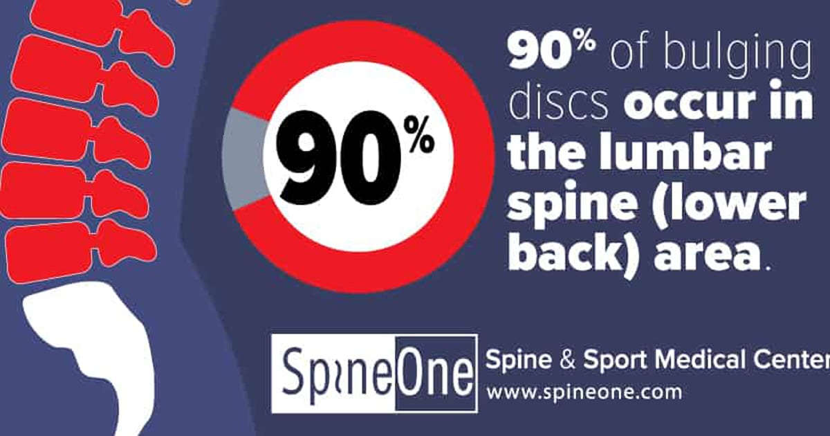 Bulging Discs by the Numbers Spine One Denver Spine Pain Specialists