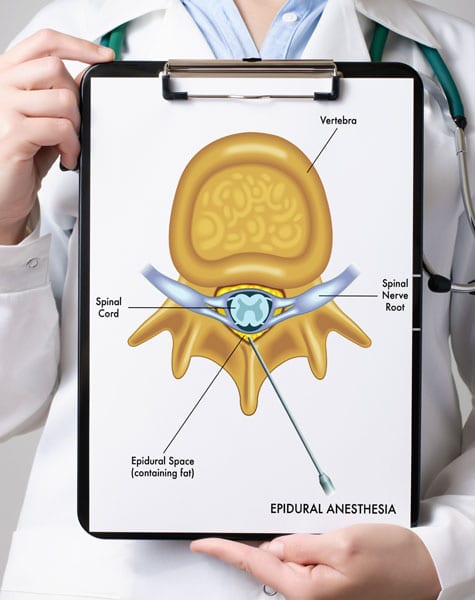 epidural-steroid-injection