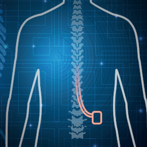 will-my-implant-be-visible Will my implant be visible